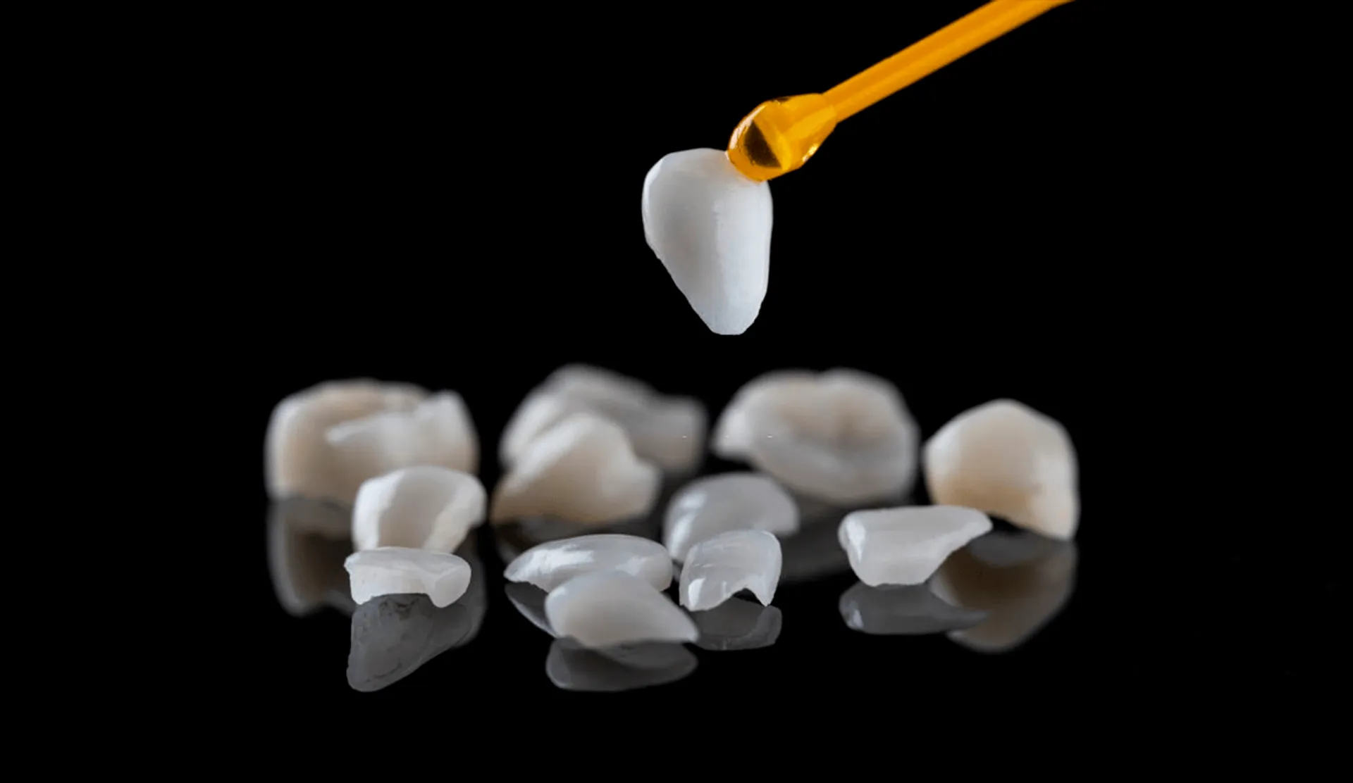 Coronas e implantes dentales